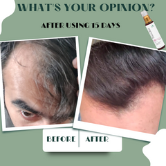 Intensive Hair oil treatment for Hair Fall